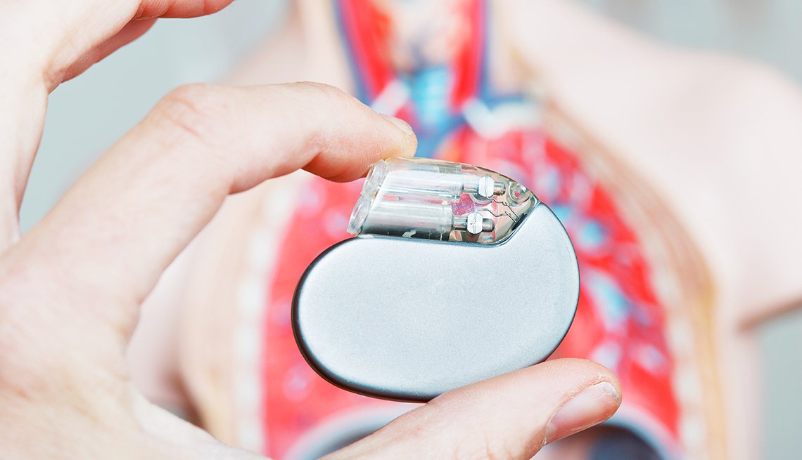 Pacemakers: When Do You Need One?