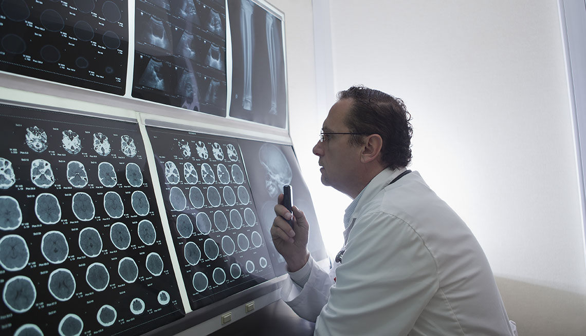 Un médico examina las radiografías cerebrales de un paciente