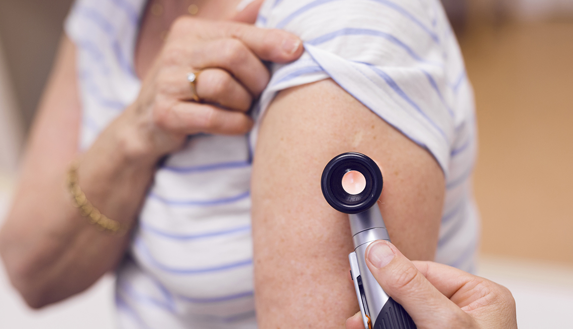 4 Melanoma Warning Signs That Are Easy to Miss
