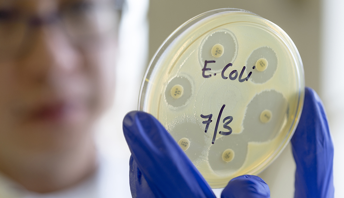 Un microbiólogo sostiene una placa de petri que dice E. Coli con fecha de julio 3