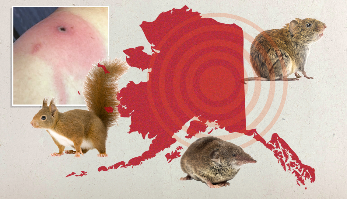 La viruela de Alaska en humanos se puede contraer de pequeños mamíferos como musarañas, topillos y ardillas rojas.