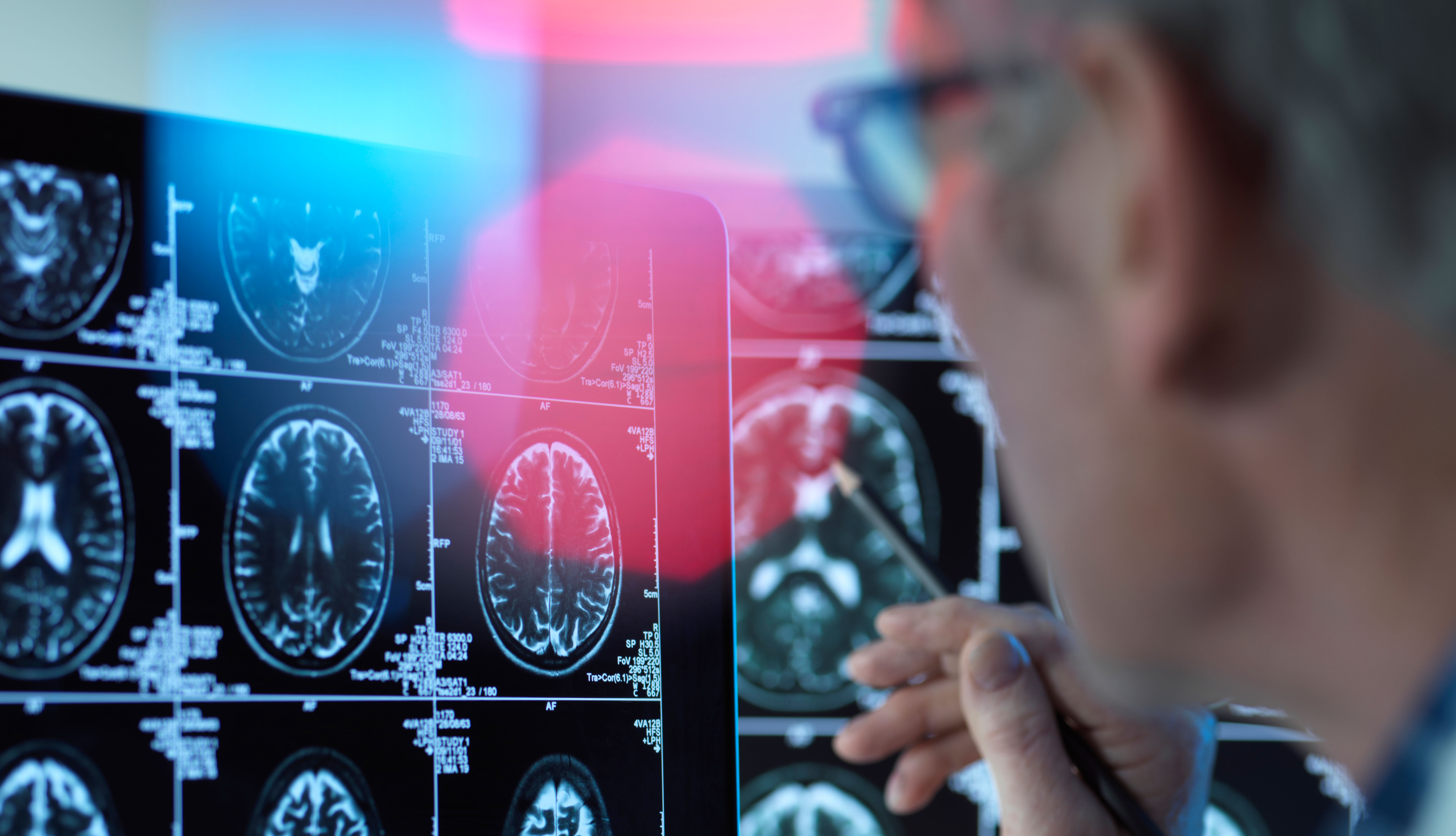 Un doctor mira una radiografía del cerebro