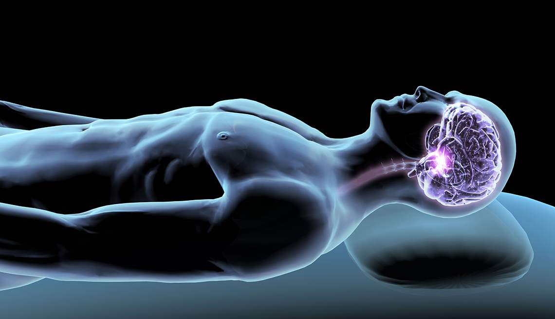 Imagen radiográfica de hombre durmiendo con enfoque en la cavidad craneal.