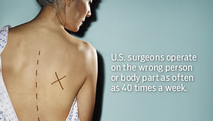 A patient's back marked with an X. U.S. surgeons operate on the wrong person or body part as often as 40 times a week.