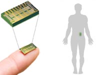 Pharmacy on a chip implanted under skin