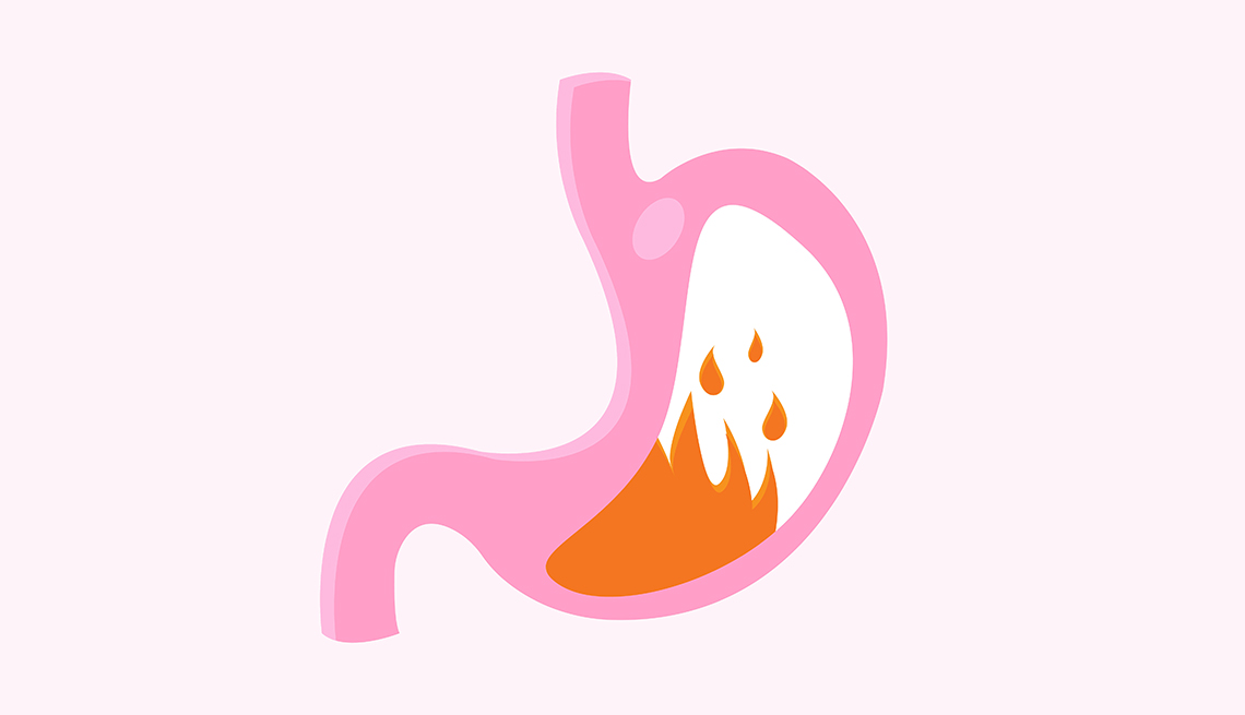 Ilustración de un estómago en llamas que representa la acidez y el reflujo
