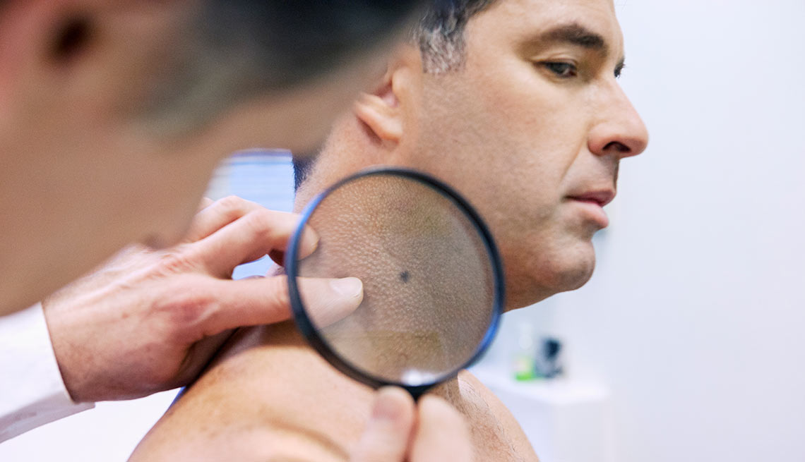 Médico examinando la piel de un paciente - Nuevas tecnologías contra el cáncer de la piel