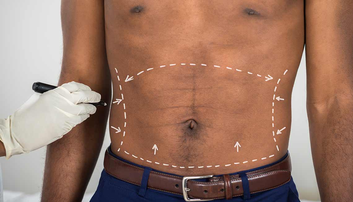Médico marcando el abdomen de un hombre
