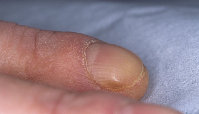 Uñas curveadas Uñas curveadas
