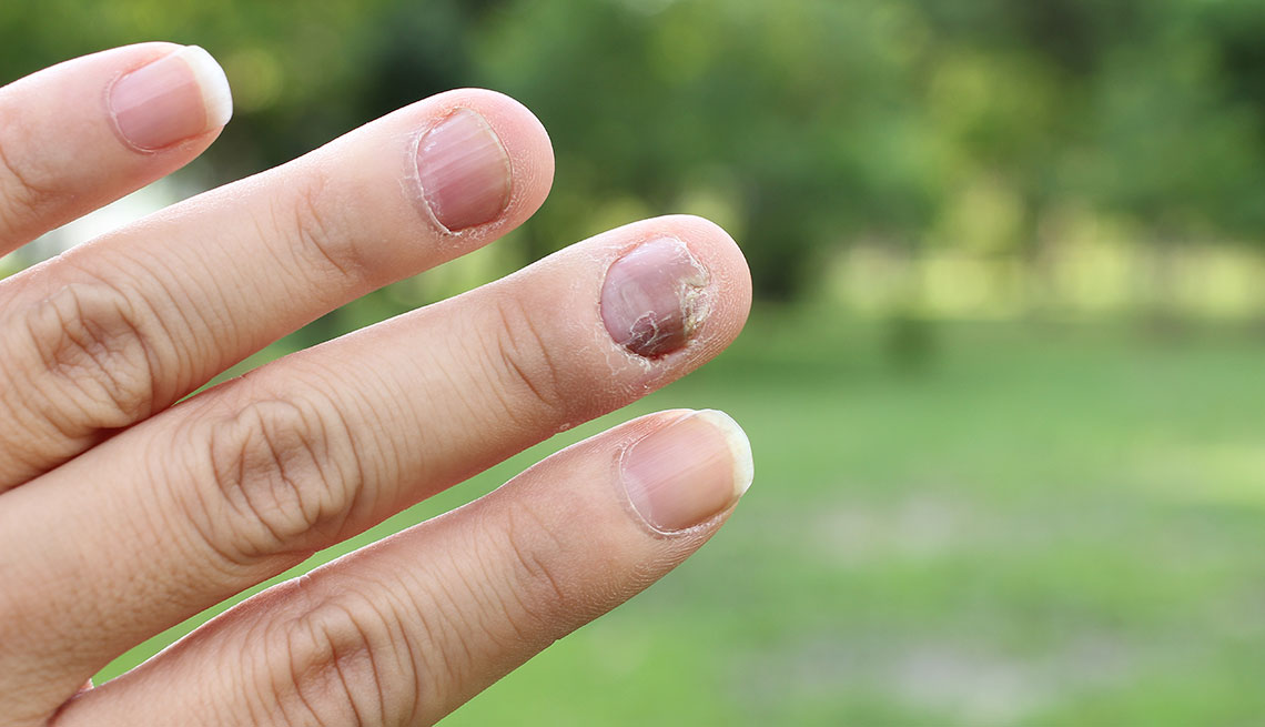 What Are Your Nails Saying About Your Health