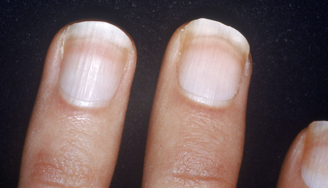 White nails 