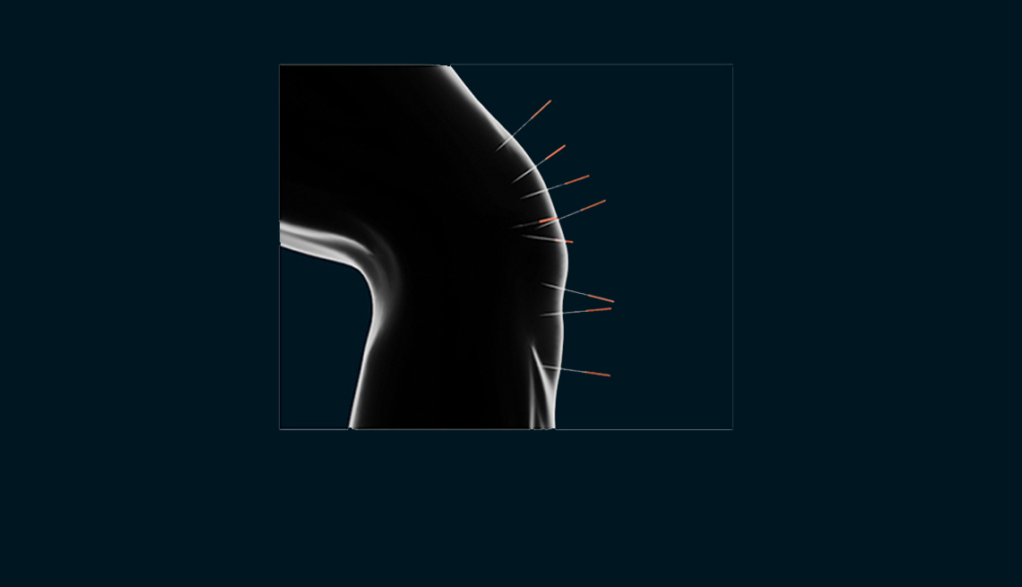 Knee Pain Solutions To Prevent Surgery