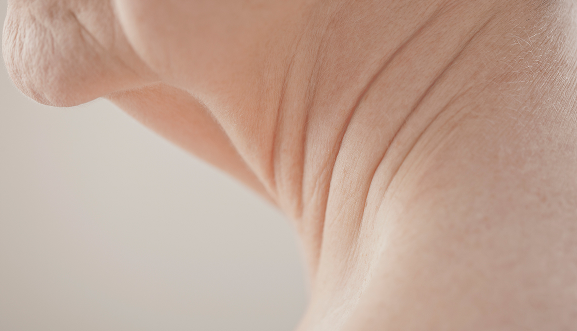 Imagen que muestra la caída del cuello, aprende de algunos tratamientos para mejorar su apariencia