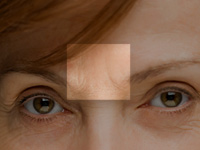 A menopausal woman’s facial wrinkles, particularly between the brow, could indicate low bone density.