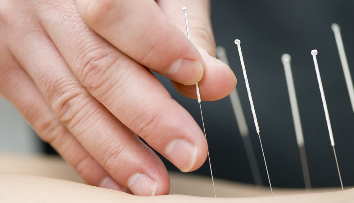 Una persona recibe un tratamiento de acupuntura