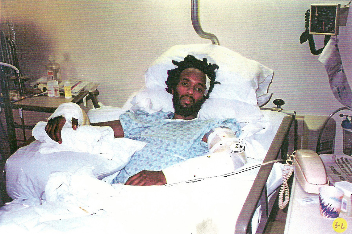Fantastic Negrito in hospital bed after car accident.