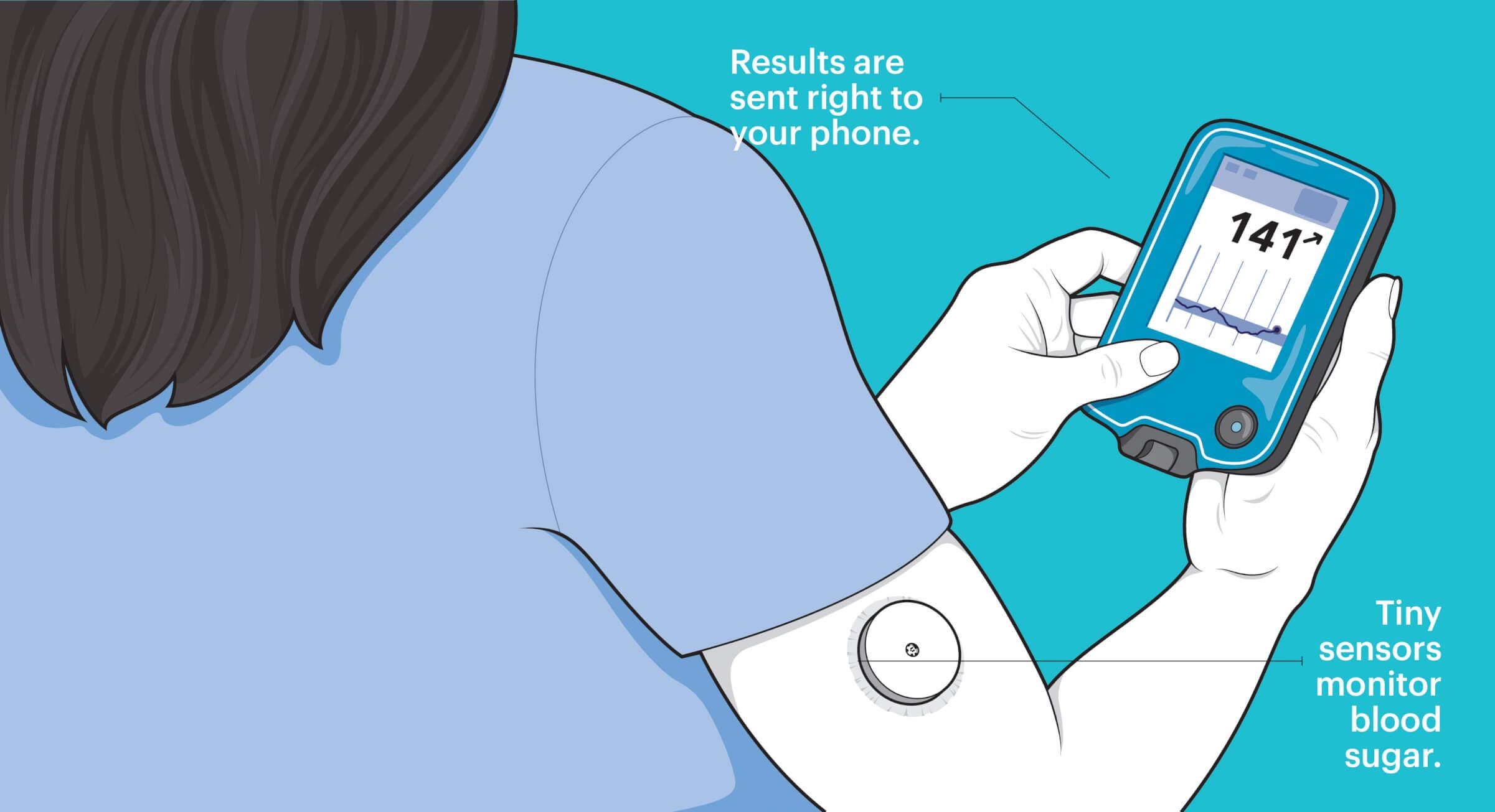 Illustration of the back of a woman with the focus being on her arm where a tiny circular device sits. She is holding a device that shoes the number 141. There is one line pointing to the device with the text saying “Tiny sensors monitor blood sugar”. Another line points at the device and has the text Results are sent right to your phone.