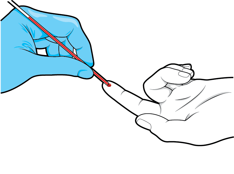 Illustration of a fingertip being pricked to draw blood out.