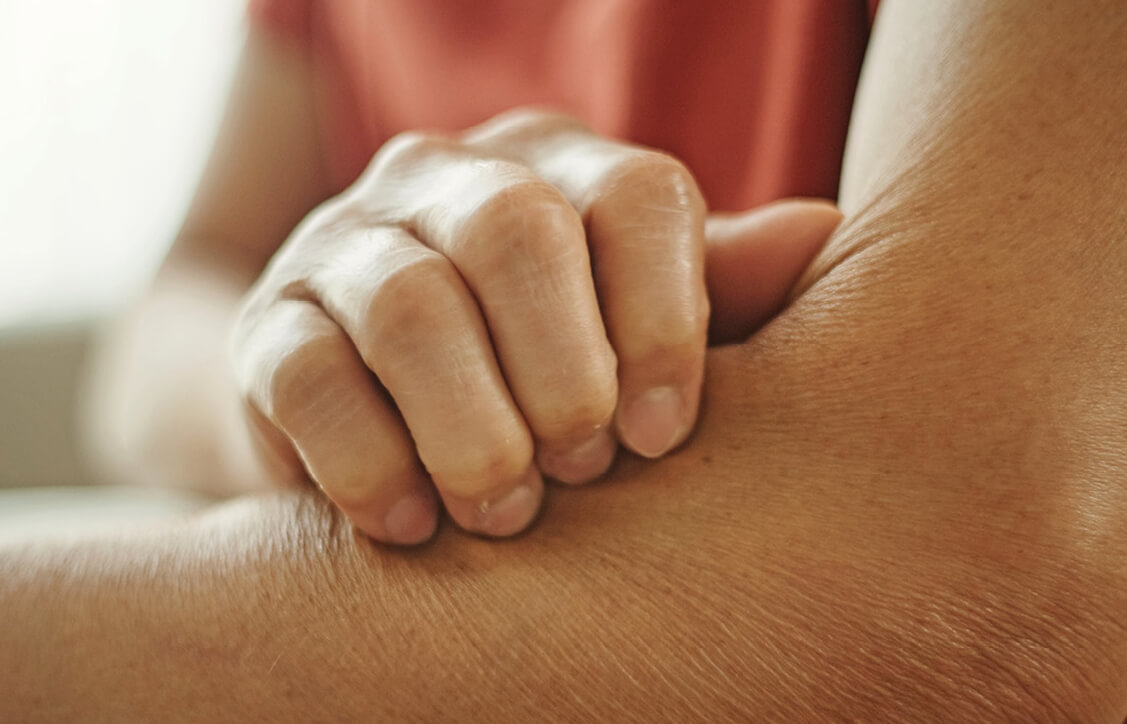 Photograph of a person itching their arm