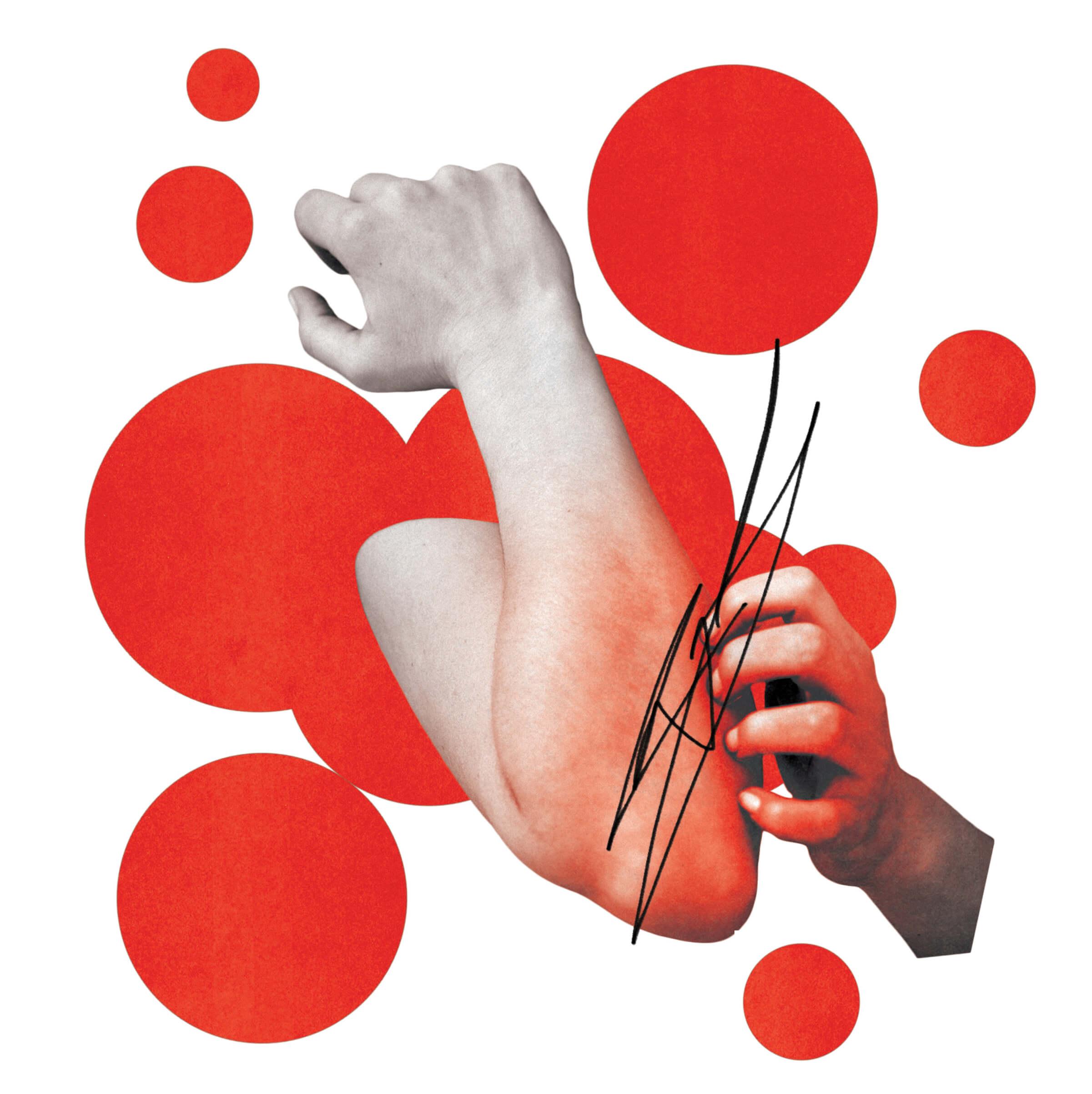 Photocollage of a hand itching their elbow. The elbow is red and big red spots are behind the arms
