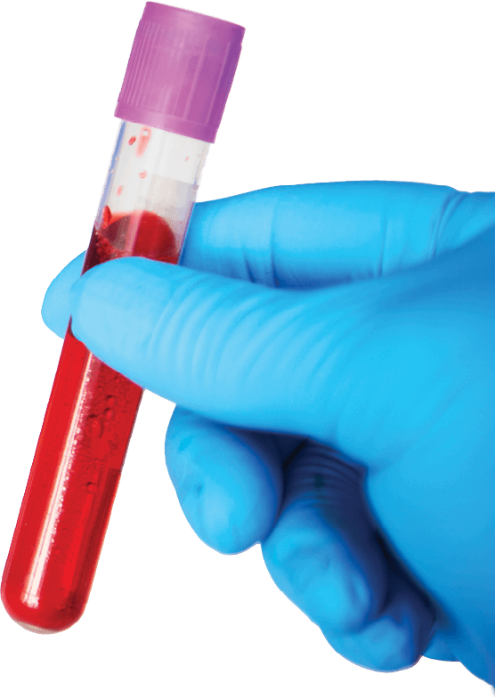 Photo of a gloved hand holding a vial of blood