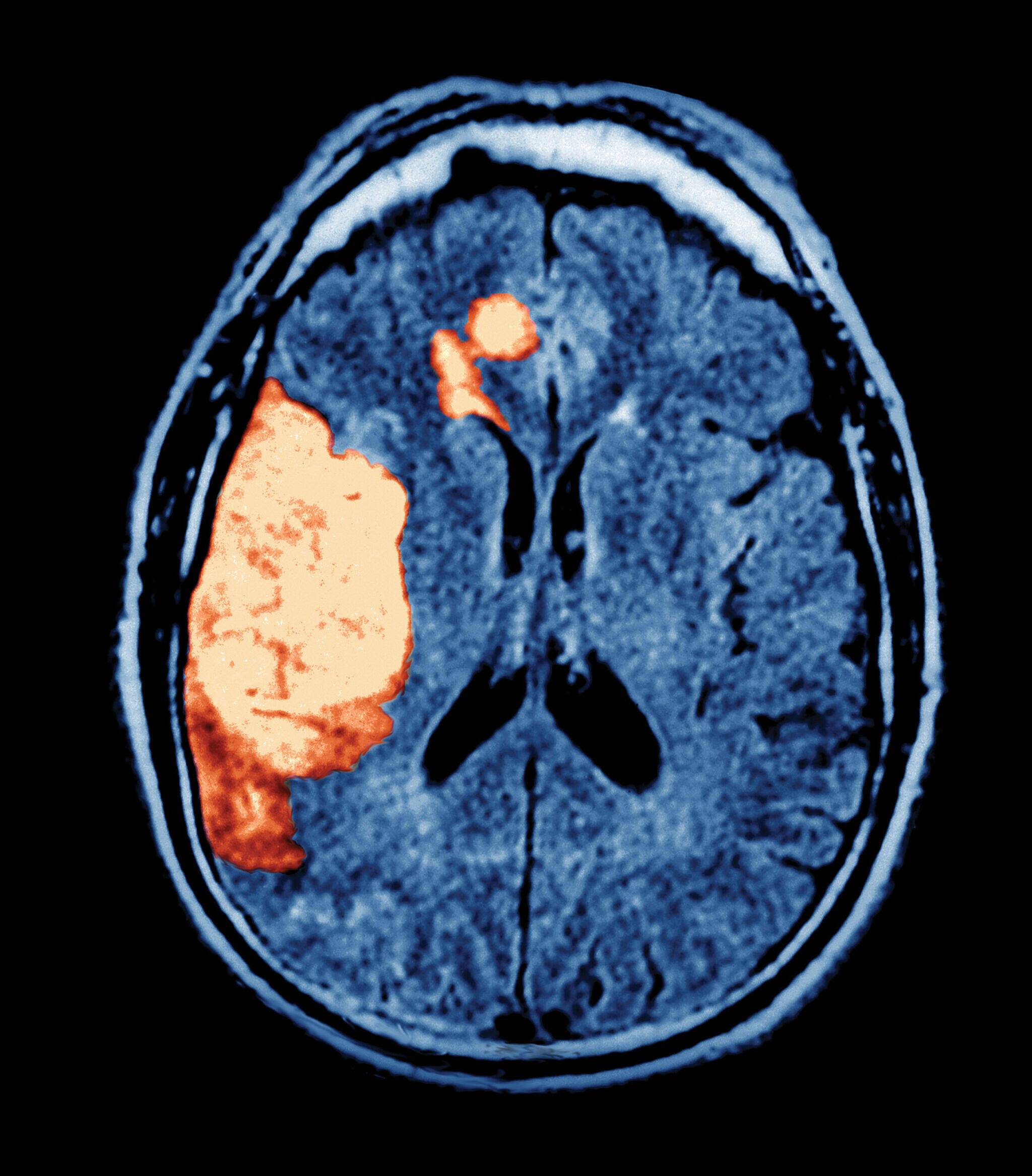 Scan of a person’s brain