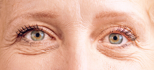 Cropped photo showing a woman's eyes