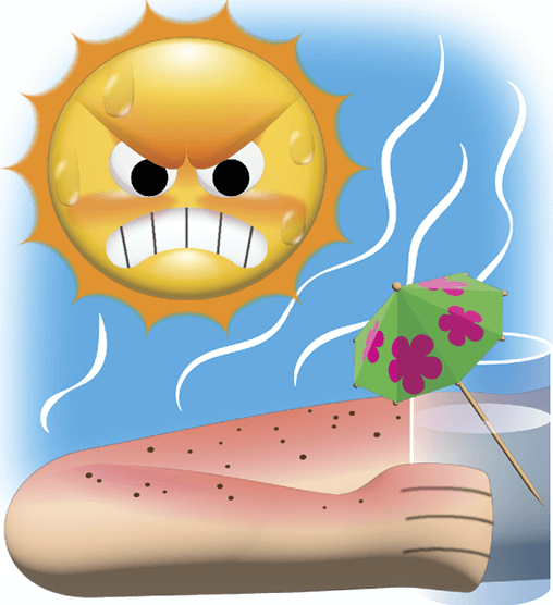 Illustration of an angry-looking sun in the blue sky overlooking a sunburnt arm that's holding a refreshing drink