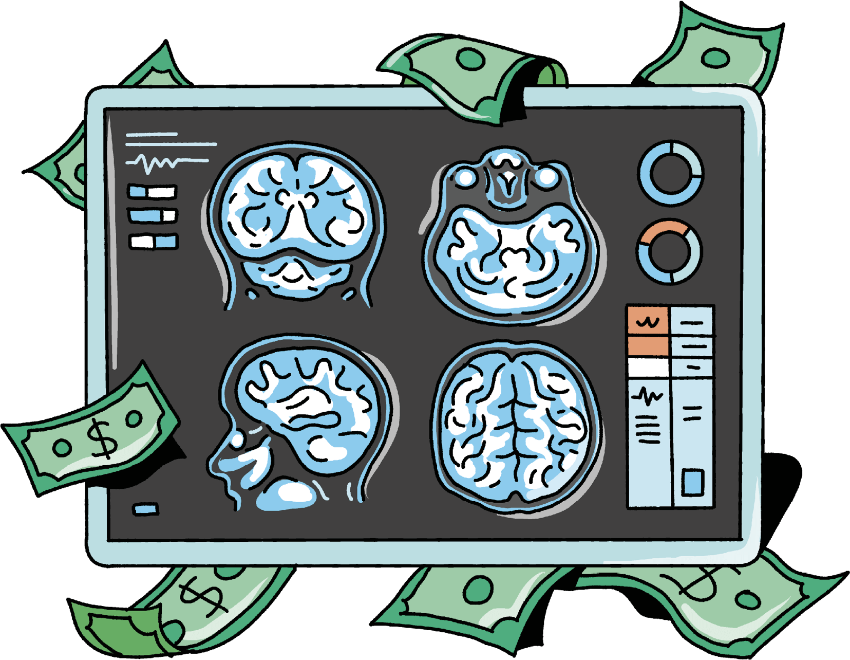 A screen showing scans of a person’s brain, with dollars bills surrounding it