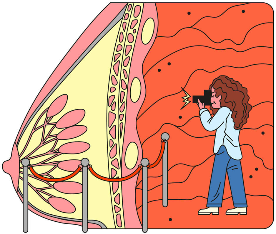 Illustration of a small woman taking photos of the inside of her breast