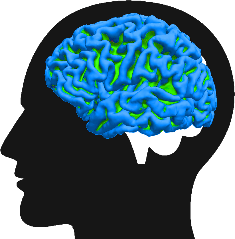 Illustration of an 84-year-old cognitively normal brain