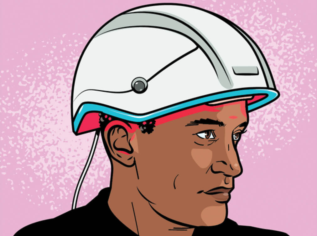 Illustration of a man wearing a light therapy cap