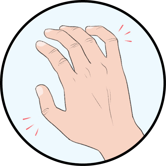 Illustration of popping joints