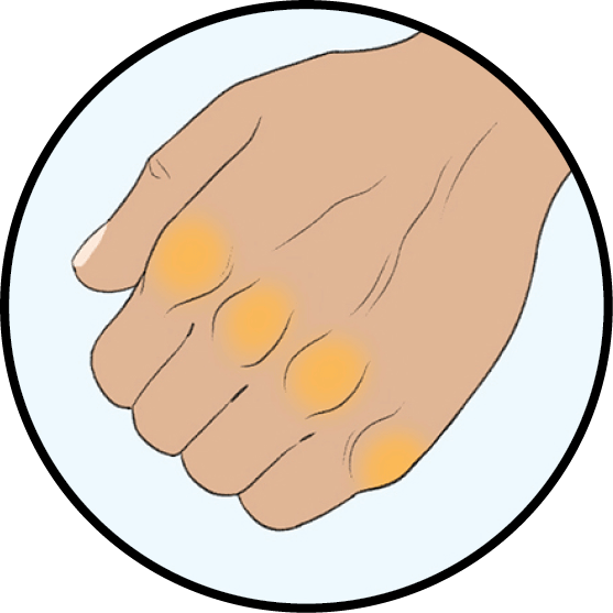 Illustration of yellow knuckles