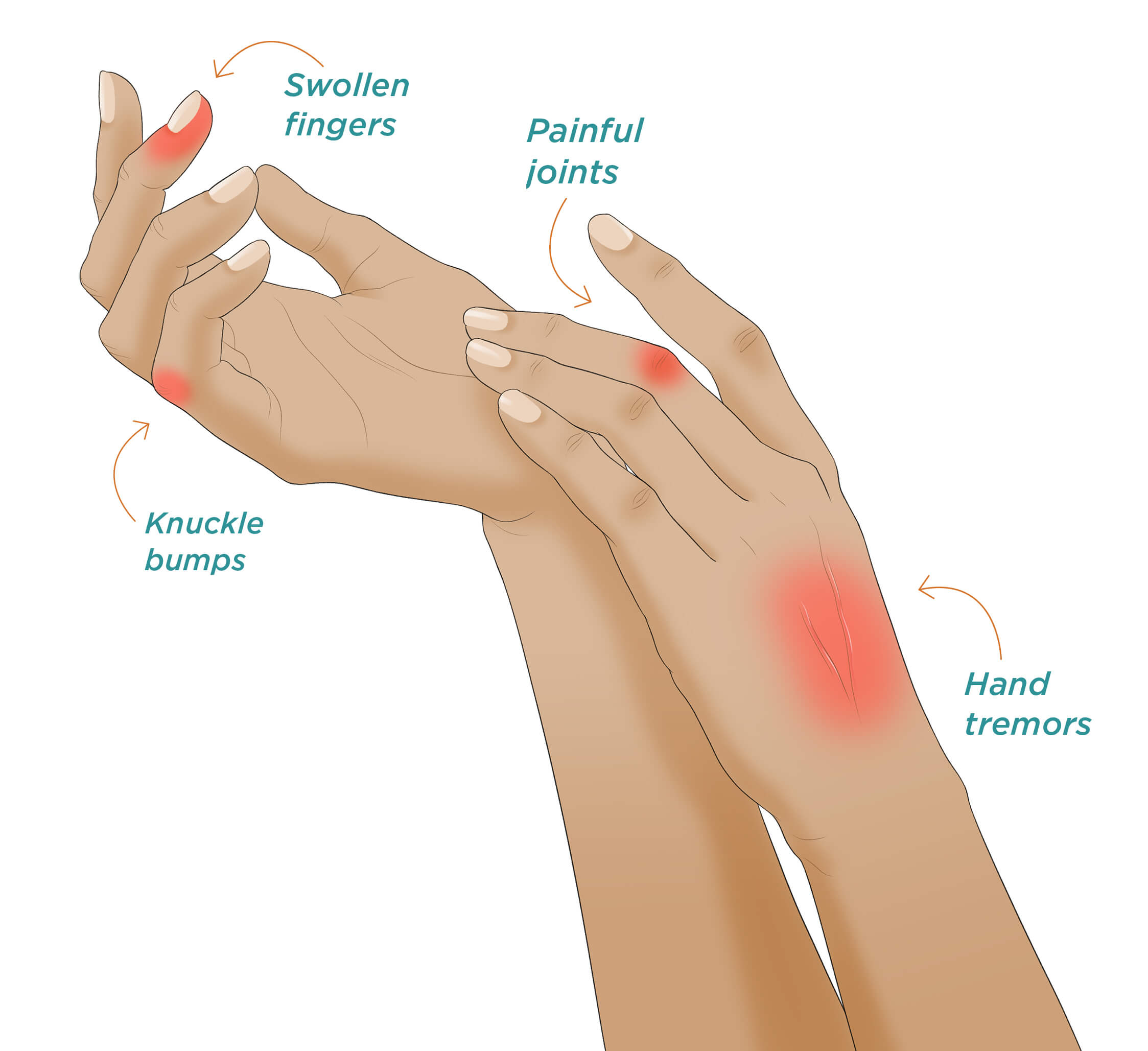 Large illustration of two hands, with various pain points highlighted red