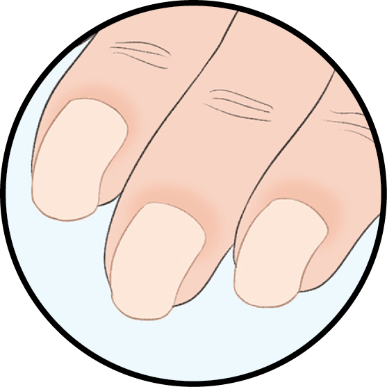 Illustration of fingernails that are curved down