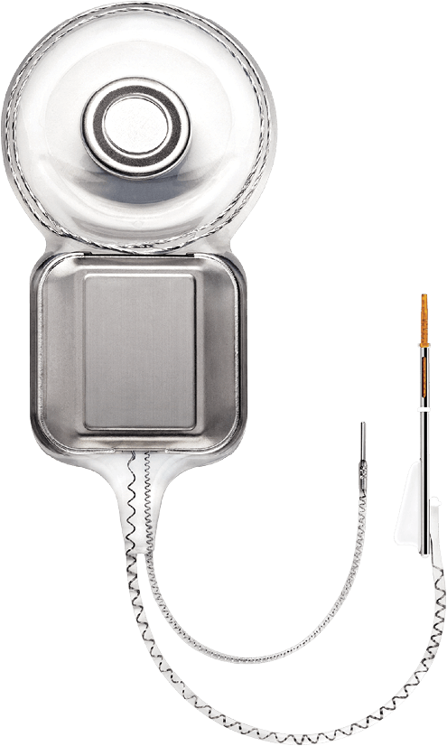 Image of a smart cochlear implant 