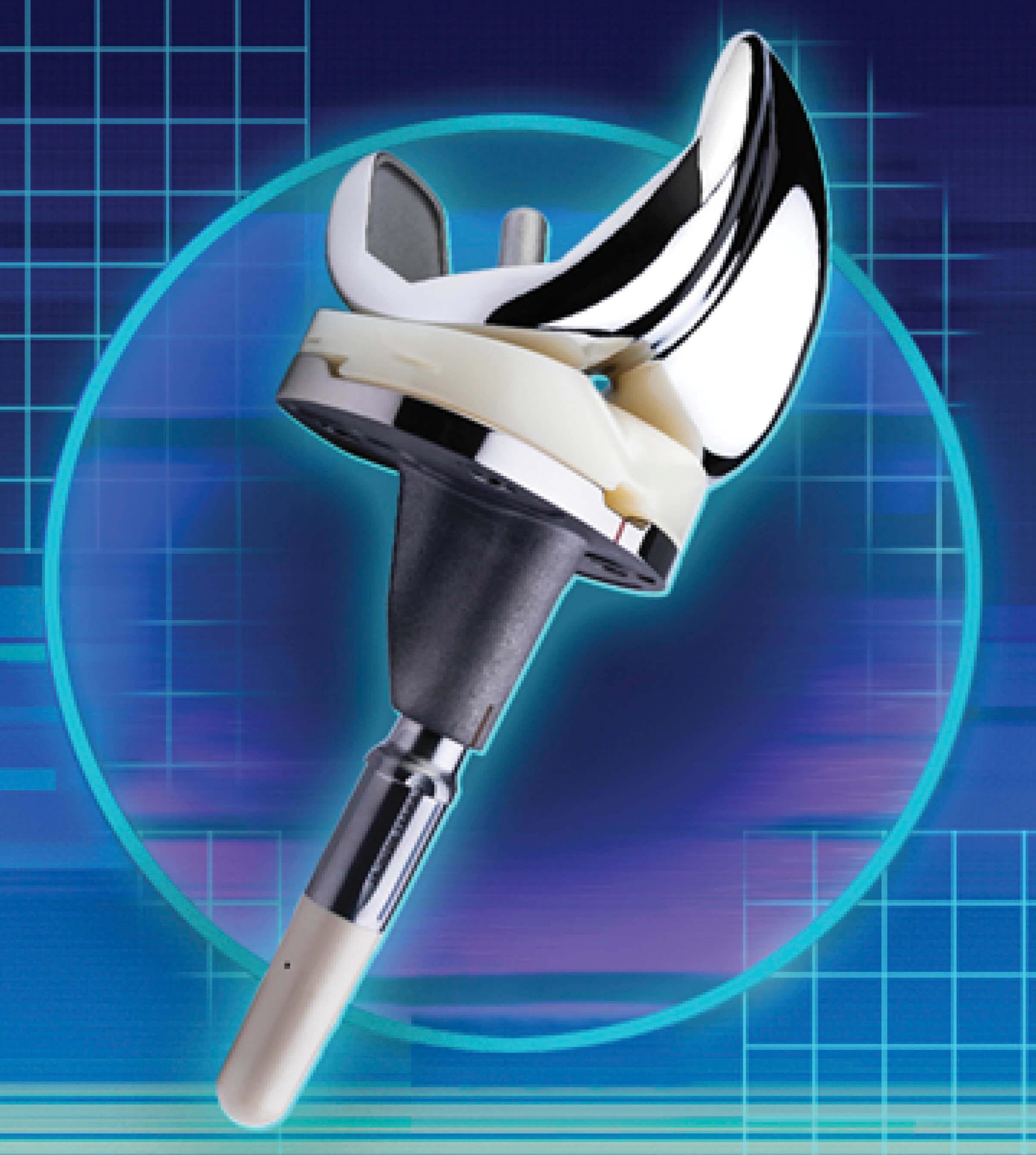 Illustration of an artificial knee joint 