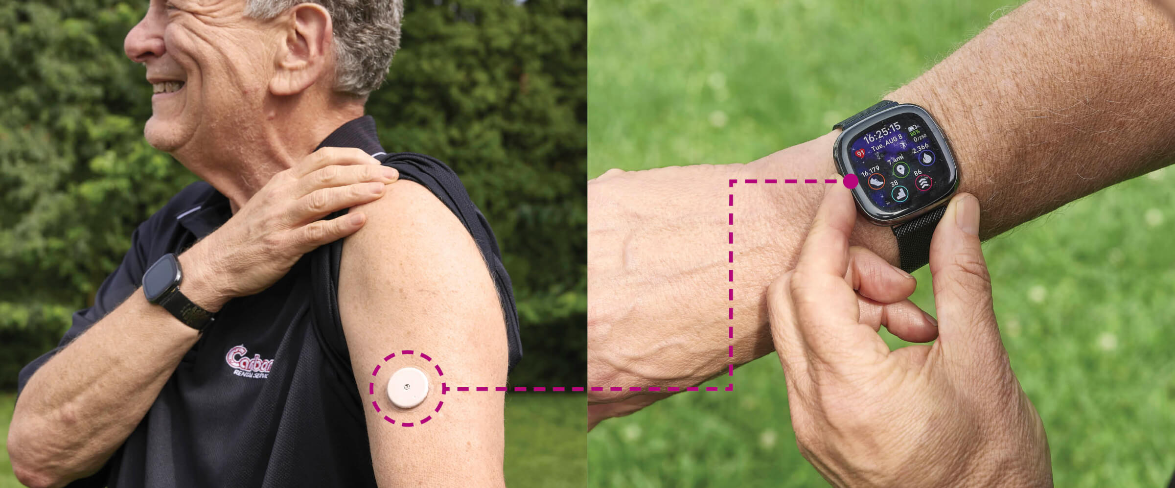 Side-by-side photos showing Andy Pincus controlling his blood sugar while wearing a Continuous Glucose Monitor