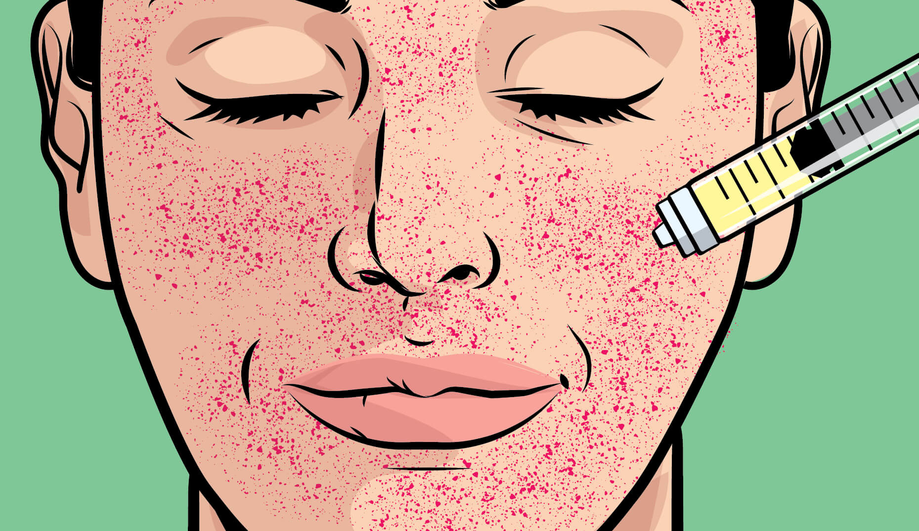 Illustration of a woman's face with a plasma injection