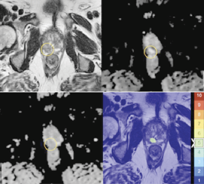 Collage of different images showing cells under a microscope