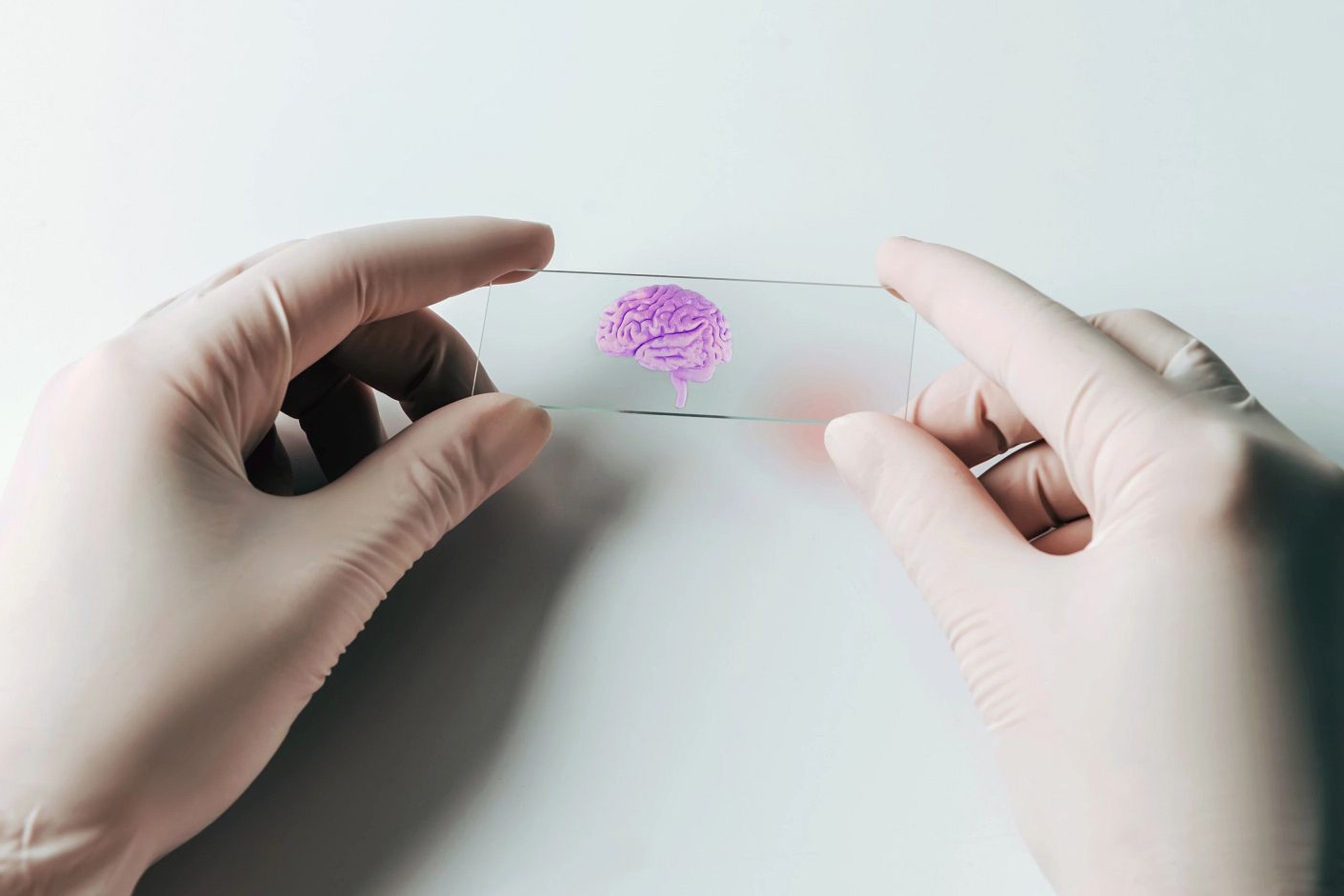 600x400-alzheimers-blood-test