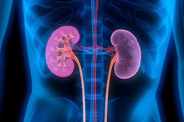 Visualization of a kidney x-ray.