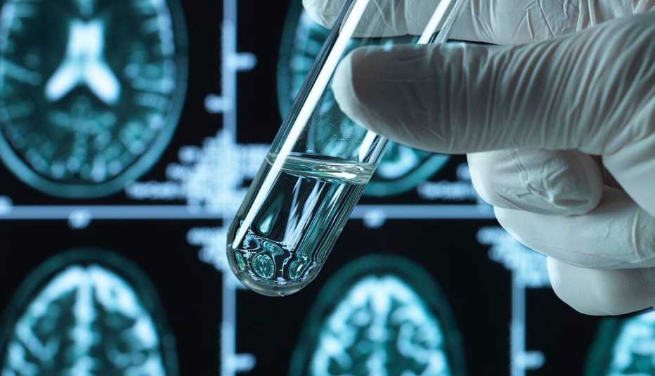 hand holding test tube in front of brain scans