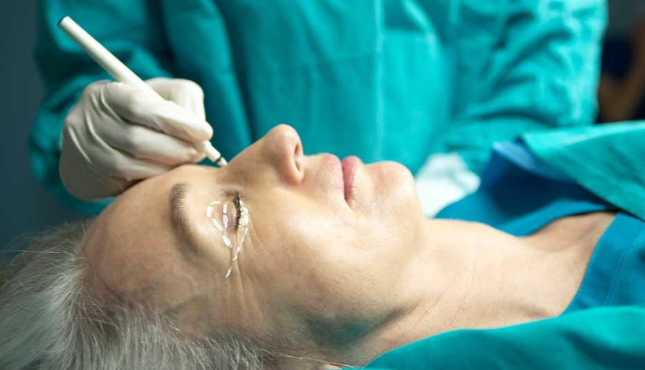 A doctor marking lines on a woman's eyelid for surgery