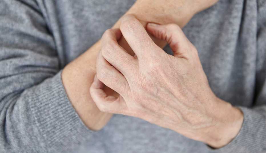 woman scratching her arm