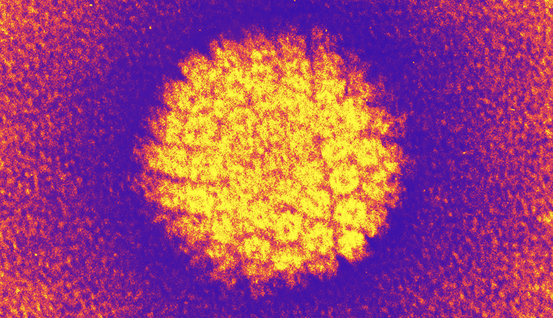 A colored transmission electron micrograph of human papilloma virus or HPV