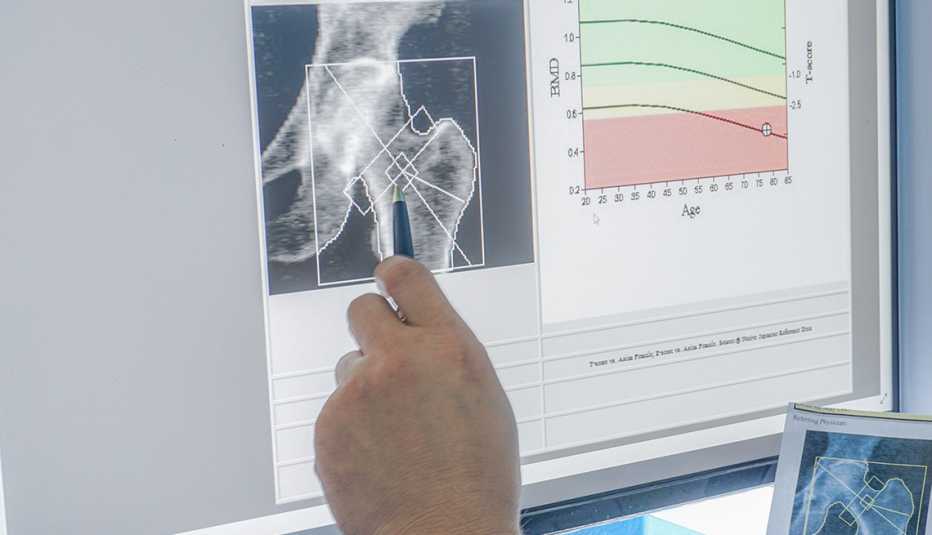 bone scan results on computer screen