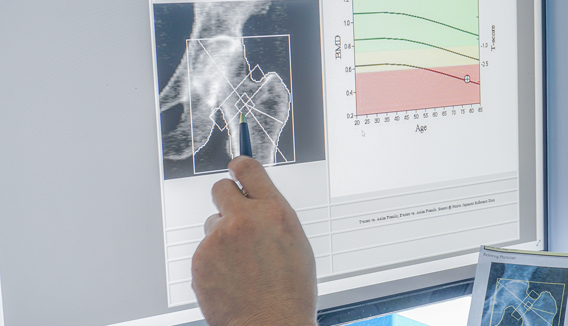 bone scan results on computer screen