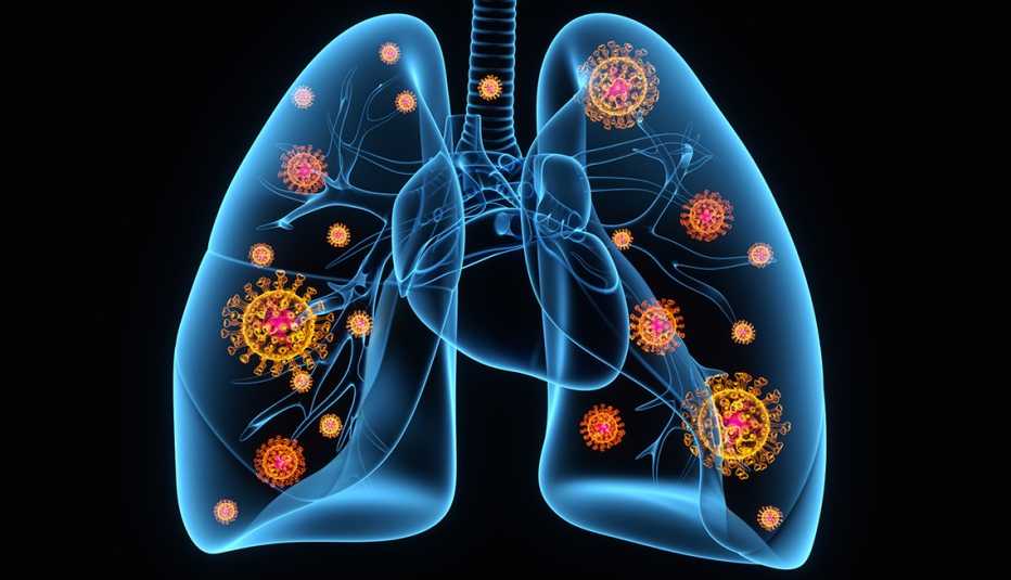 illustration of the lungs with coronavirus cells inside